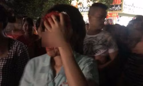 Xot xa nguoi vo bi chong danh den chay mau dau phai nhap vien