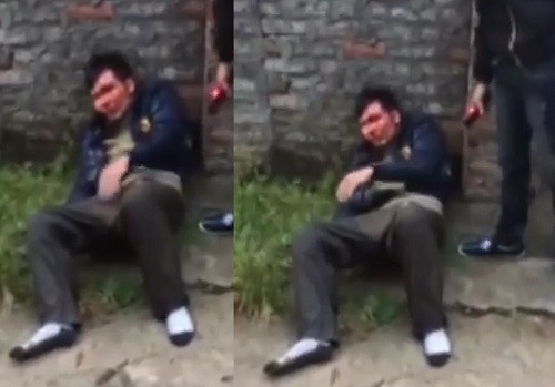 Thanh niên trộm chó bị đánh chảy máu đầu Thanh nien trom cho bi danh chay mau dau