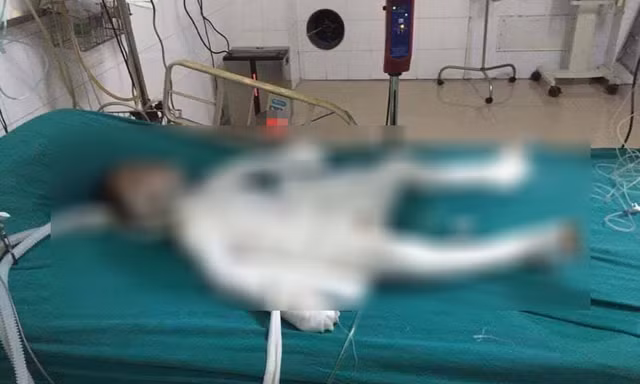 Bo duong dot nha lam con trai 6 tuoi chet doi mat hinh phat nao?