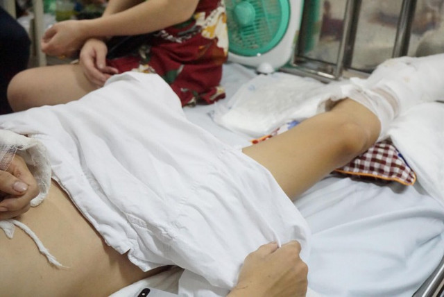 Nam thanh niên sợ hãi nhớ lại phút bị truy sát chém nát chân - Hình 2 Nam thanh nien so hai nho lai phut bi truy sat chem nat chan-Hinh-2