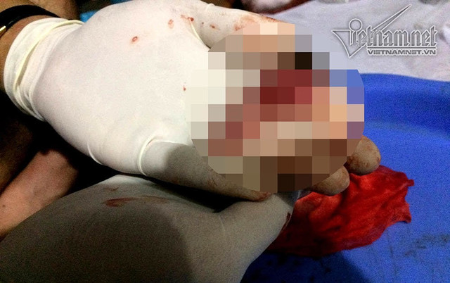 Chang sinh vien 2 nam di nhat 3.000 xac thai nhi-Hinh-2