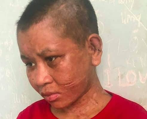 Hãi hùng người phụ nữ bị tra tấn tới biến dạng ở Gia Lai Hai hung nguoi phu nu bi tra tan toi bien dang o Gia Lai