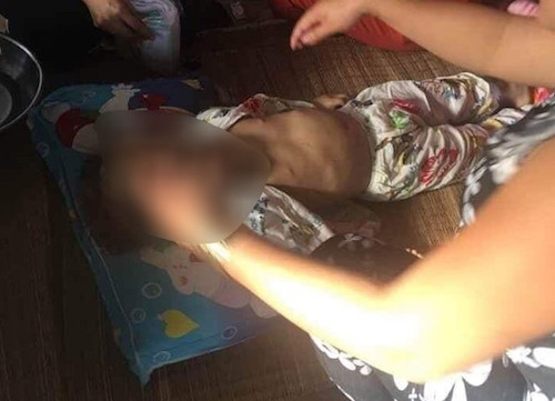 Hình ảnh bé gái nghi bị bạo hành được chia sẻ trên mạng. Ảnh: CAND Hình ảnh bé gái nghi bị bạo hành được chia sẻ trên mạng. Ảnh: CAND