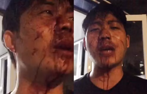 Dat Xanh len tieng vu cu dan Opal Riverside “to” bi bao ve danh trong thuong