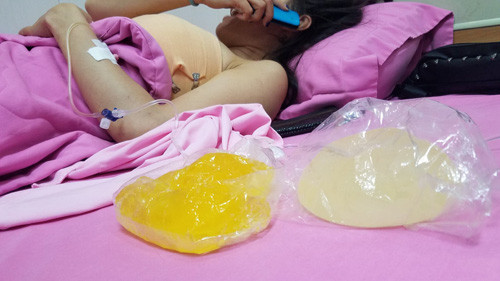 Ca sĩ Ivy Trần gặp “sự cố”: Nạn nhân tố bác sĩ vô trách nhiệm (!?) - Hình 2 Ca si Ivy Tran gap “su co”: Nan nhan to bac si vo trach nhiem (!?)-Hinh-2