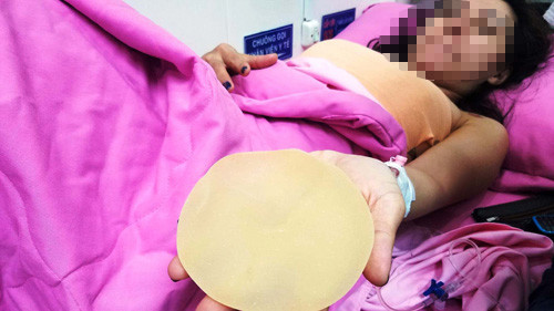 Ca sĩ Ivy Trần gặp “sự cố”: Nạn nhân tố bác sĩ vô trách nhiệm (!?) Ca si Ivy Tran gap “su co”: Nan nhan to bac si vo trach nhiem (!?)