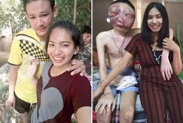 Người vợ vẫn bên chồng dù anh có ra sao.