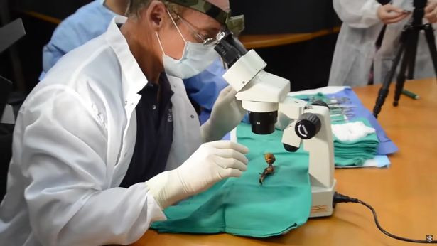 Bộ xương lần đầu được phát hiện ở Chile vào năm 2003. Bộ xương lần đầu được phát hiện ở Chile vào năm 2003.