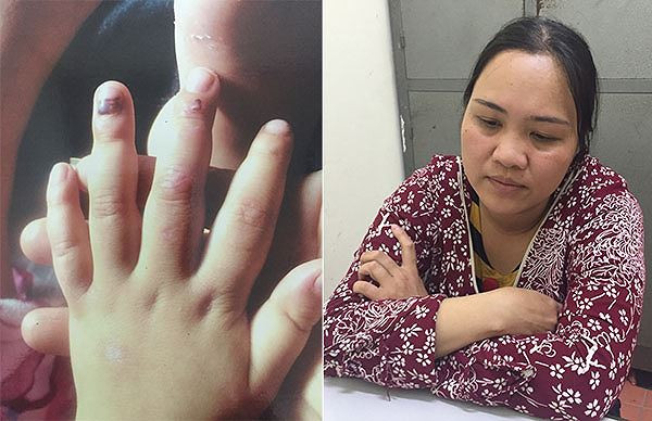 Bà Hải (bìa phải) đã hành hạ con gái người tình; trong đó đánh làm các ngón tay trẻ bầm dập (bìa trái). *ảnh: Nguyệt My Bà Hải (bìa phải) đã hành hạ con gái người tình; trong đó đánh làm các ngón tay trẻ bầm dập (bìa trái). *ảnh: Nguyệt My