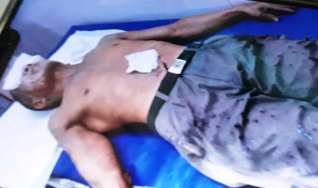 Thái Bình: Đang điều tra nghi án tạt axit ông lão 67 tuổi - Hình 2 Thai Binh: Dang dieu tra nghi an tat axit ong lao 67 tuoi-Hinh-2