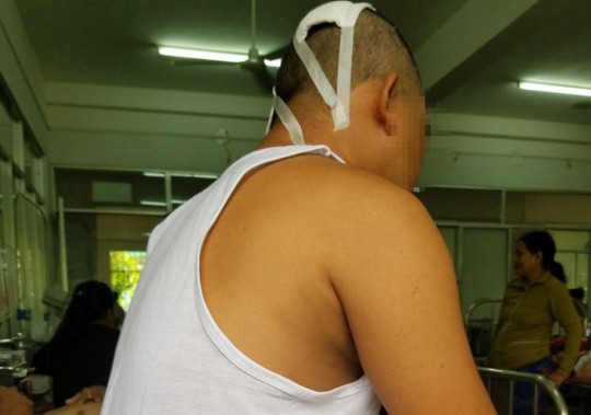 Anh D. bị Dũng dùng rựa chém vào đầu khi đang ngủ. Ảnh: Tùng Sơn Anh D. bị Dũng dùng rựa chém vào đầu khi đang ngủ. Ảnh: Tùng Sơn