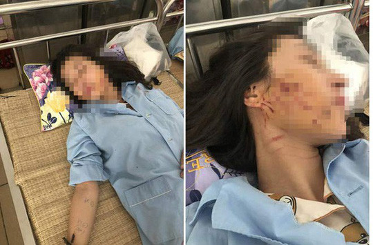 Chị L.T.G. bị thương ở mặt lúc điều trị tại bệnh viện. Chị L.T.G. bị thương ở mặt lúc điều trị tại bệnh viện.