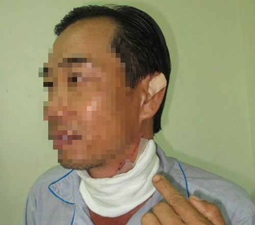 Ông N. chỉ tay vào vết cứa ở cổ (Ảnh: Thanh Lâm).