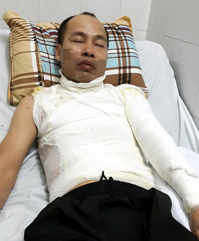 Kinh hoàng cha bị tạt axit trước mặt con gái ở Hà Nội Kinh hoang cha bi tat axit truoc mat con gai o Ha Noi