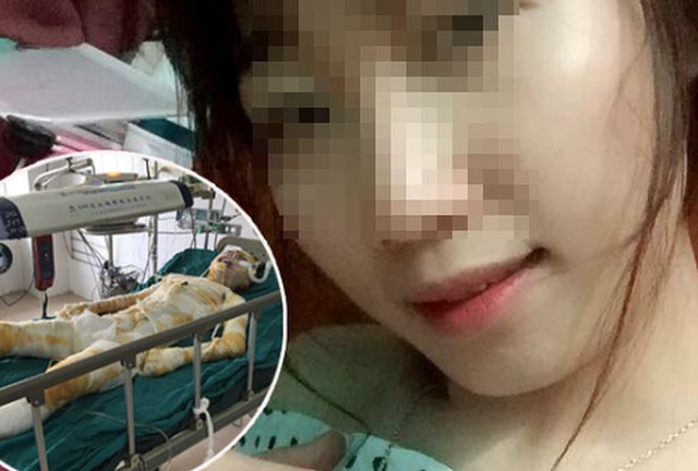 Nạn nhân H. Ảnh: ANTĐ.