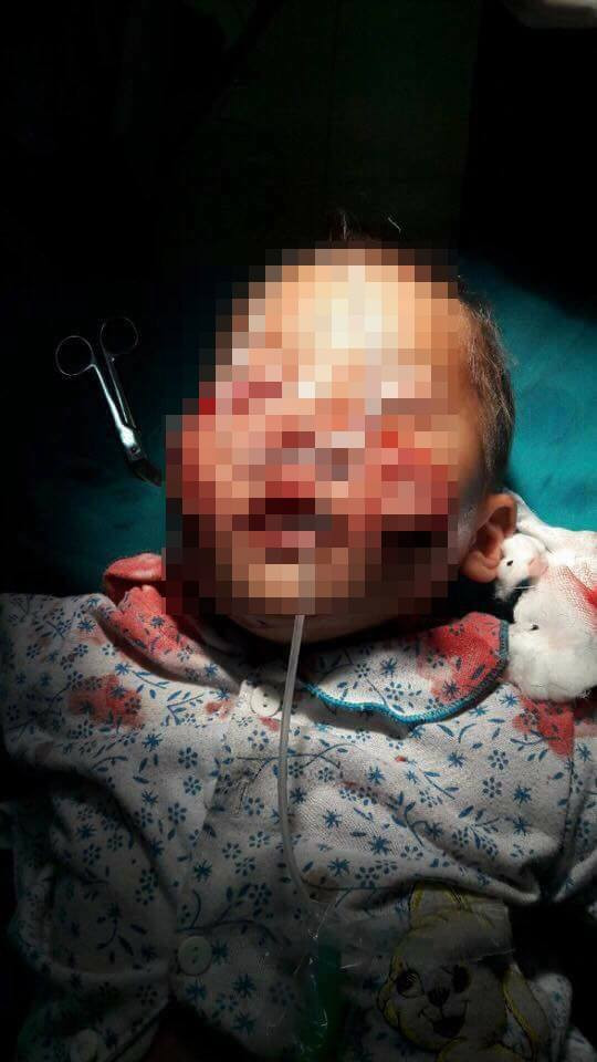 Cháu Trường vẫn đang được các bác sĩ điều trị tích cực. Cháu Trường vẫn đang được các bác sĩ điều trị tích cực.