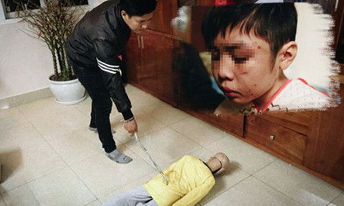 Hôm nay, cha đẻ và mẹ kế bạo hành con trai 10 tuổi hầu tòa Hom nay, cha de va me ke bao hanh con trai 10 tuoi hau toa