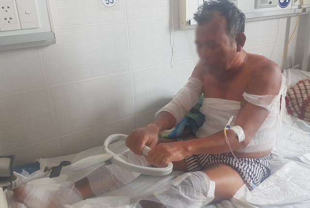 Rò rỉ khí gas, 2 vợ chồng bị bỏng nặng Ro ri khi gas, 2 vo chong bi bong nang