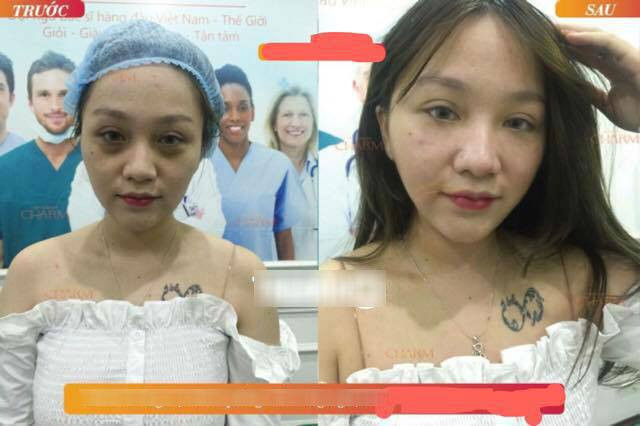Cái tên Hera Kiều Anh thời gian qua cực nổi trên mạng xã hội khi vụ lùm xùm bị bồ cũ dọa tung clip nóng thu hút sự chú ý cực lớn từ dân mạng. Im lặng chờ "bão qua", mới đây nữ streamer này bất ngờ trở lại khi xuất hiện tại một thẩm mỹ viện để "trùng tu" nhan sắc. Cái tên Hera Kiều Anh thời gian qua cực nổi trên mạng xã hội khi vụ lùm xùm bị bồ cũ dọa tung clip nóng thu hút sự chú ý cực lớn từ dân mạng. Im lặng chờ "bão qua", mới đây nữ streamer này bất ngờ trở lại khi xuất hiện tại một thẩm mỹ viện để "trùng tu" nhan sắc.