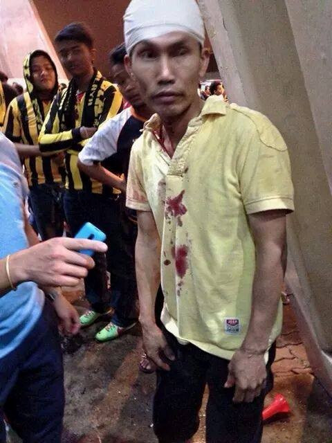 Một fan Malaysia đăng tải tấm ảnh CĐV Việt Nam bê bết máu cùng dòng nhắn: "Xin lỗi bạn. Hãy tha thứ cho chúng tôi".