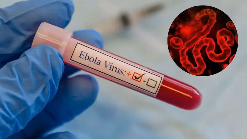 Nguy cơ Ebola xâm nhập Việt Nam, Bộ Y tế yêu cầu siết chặt phòng dịch