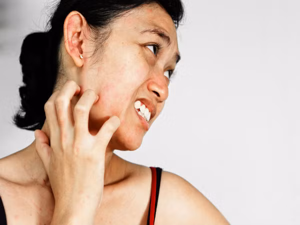 Rối loạn nội tiết: Trong nhóm những người gan nhiễm mỡ nặng có người có thể xuất hiện các triệu chứng ở nam giới như tuyến vú nam giới phát triển, teo tinh hoàn, chức năng cương dương gặp trở ngại, còn với phụ nữ là rong kinh, tắc kinh, cân nặng của người bệnh giảm hoặc tăng…Ảnh: Boldsky.