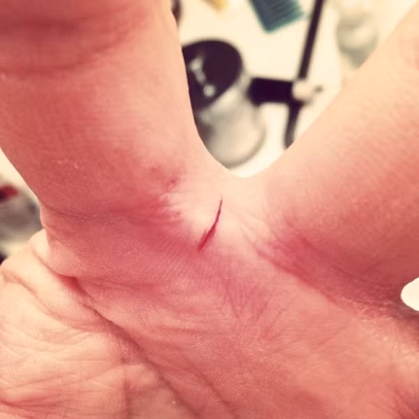 Vết cắt của giấy thực sự còn đau hơn vết cắt của dao.