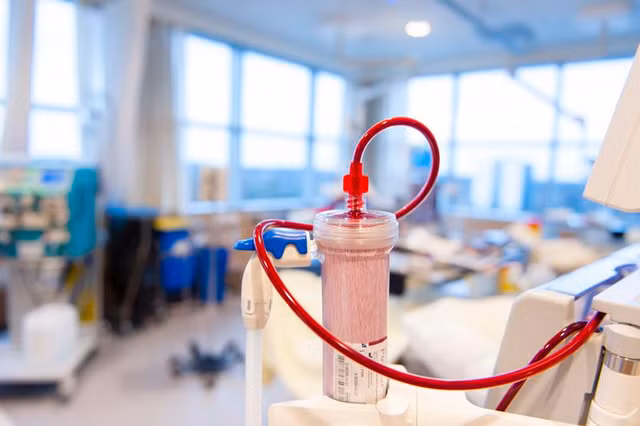 Hiem hoa tu “trao luu” loc mau ngua dot quy, tim mach