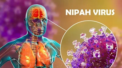 Virus Nipah có thể gây viêm hô hấp, viêm não dẫn đến tử vong (Ảnh: Getty).