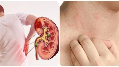 Khi chức năng thận suy giảm, có thể xuất hiện tình trạng da khô và ngứa. Ảnh: Internet.