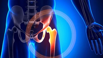 Thoái hóa khớp khiến cho người bệnh đau đớn khi đi lại