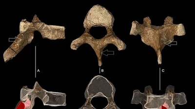 Bằng chứng cổ xưa về ung thư trong hóa thạch người tiền sử