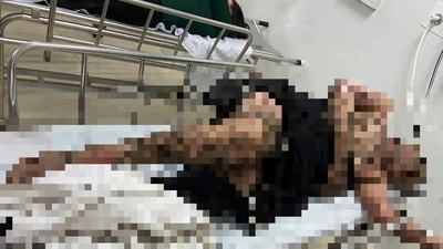 Người đàn ông bị bỏng nặng khi câu cá vướng dây điện