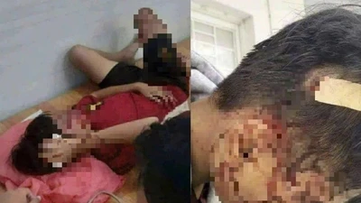 An Giang: Nhóm học sinh xô xát, một nam sinh bị thương