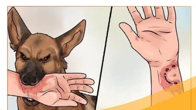 Thêm một trường hợp tử vong do bệnh dại tại Đồng Nai