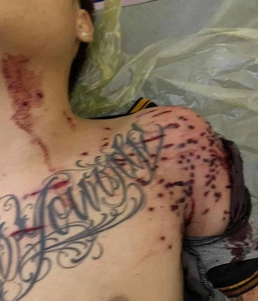 Thanh niên trong vụ nổ súng ở trạm BOT vẫn chưa qua cơn nguy kịch - Hình 2 Thanh nien trong vu no sung o tram BOT van chua qua con nguy kich-Hinh-2