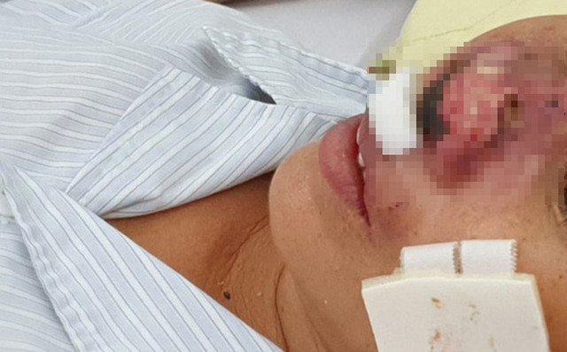 4 bệnh nhân tử vong tại Quảng Trị do mắc bệnh 'vi khuẩn ăn thịt người' 4 benh nhan tu vong tai Quang Tri do mac benh 'vi khuan an thit nguoi'