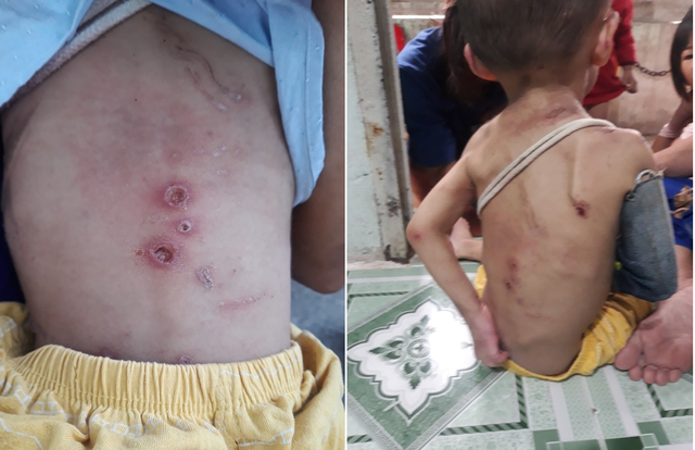 Nhìn thấy thương hình ảnh bé trai hơn 1 tuổi bị bạo hành dã man Nhin thay thuong hinh anh be trai hon 1 tuoi bi bao hanh da man