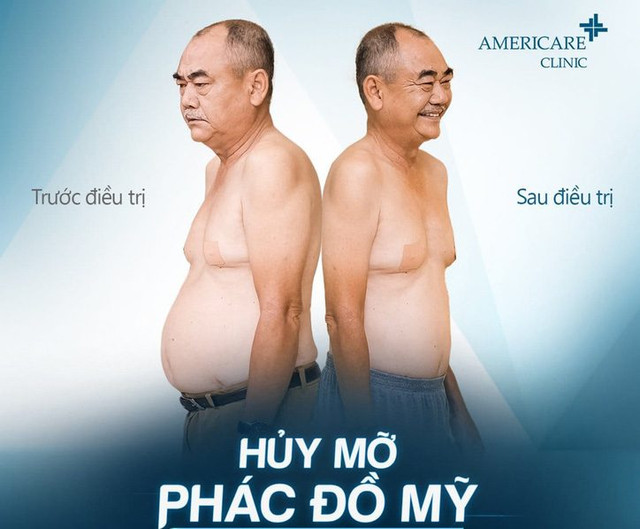 Nghệ sĩ nào tham gia quảng cáo giảm mỡ bụng cho Americare clinic? - Hình 2 Nghe si nao tham gia quang cao giam mo bung cho Americare clinic?-Hinh-2