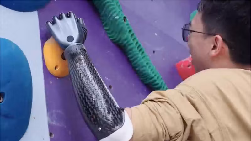 Cánh tay giả đọc suy nghĩ gây chấn động thế giới