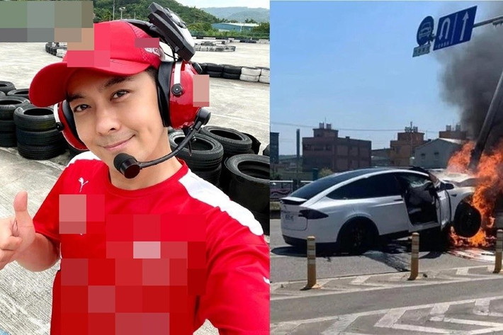 Lâm Chí Dĩnh trải qua nhiều cuộc phẫu thuật lớn, bao gồm ghép titan vào tay và tái tạo xương mặt. Sau tai nạn, anh chỉ còn khoảng 45 kg, mang nhiều vết sẹo phẫu thuật. Ảnh: Tiền Phong.