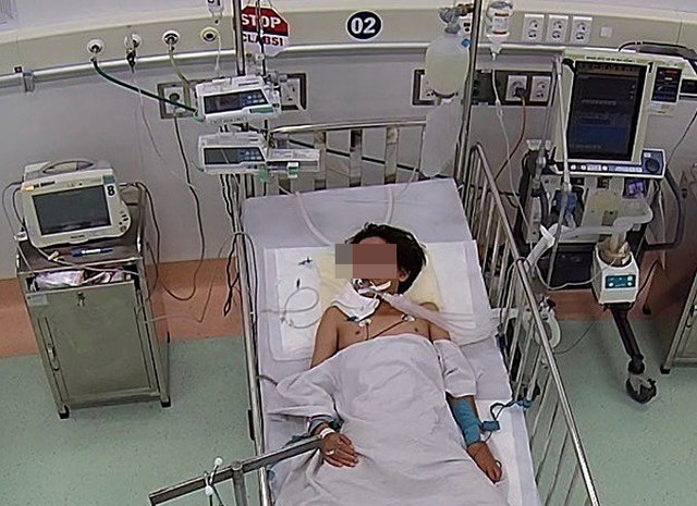 Nguy kịch vì bị rắn cạp nia chui vào nhà cắn Nguy kich vi bi ran cap nia chui vao nha can