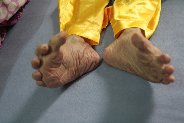 Biết gì về “bàn chân Giao Chỉ” của người Việt cổ? - Hình 2 Biet gi ve “ban chan Giao Chi” cua nguoi Viet co?-Hinh-2