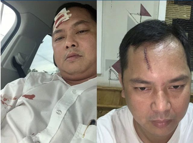 Hàng trăm giang hồ xăm trổ bao vây xe chở công an diễn ra như thế nào? - Hình 13 Hang tram giang ho xam tro bao vay xe cho cong an dien ra nhu the nao?-Hinh-13