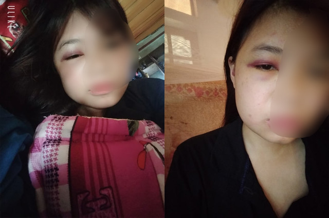 (Đã edit) Điều tra nhóm nữ sinh lớp 10 liên tiếp đánh bạn rồi tung lên mạng xã hội ở Quảng Bình (Da edit) Dieu tra nhom nu sinh lop 10 lien tiep danh ban roi tung len mang xa hoi o Quang Binh