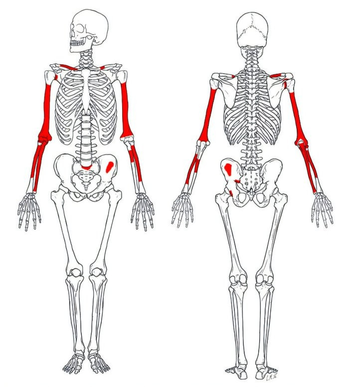 Đó là một bộ xương người Homo habilis được bảo quản cực kỳ tốt. Ảnh: @Đại học Stony Brook.
