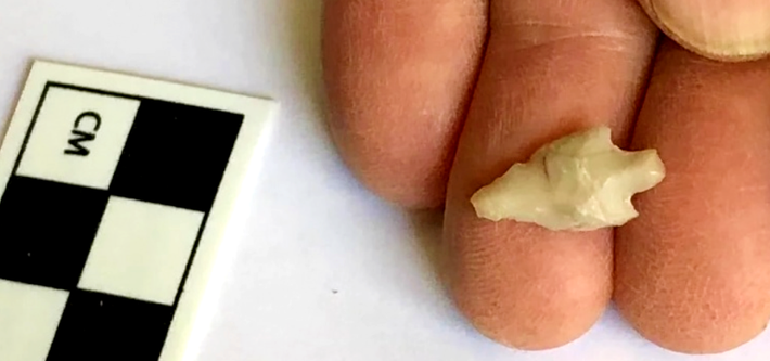 Các kỹ thuật thăm dò, phân tích khảo cổ học chuyên sâu cho thấy, đó là một đầu mũi tên siêu nhỏ, chỉ dài 1,5 cm. Ảnh: @Cơ Quan Cổ Vật Israel.