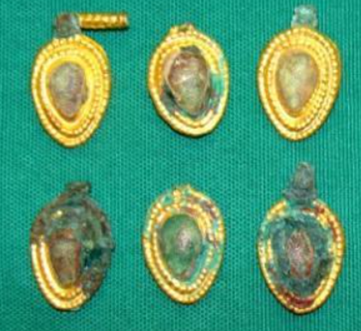 Các hiện vật được khai quật cho thấy chúng thuộc sở hữu của tầng lớp thượng lưu. Ảnh: @Bảo Tàng Cộng Hòa Azerbaijan.