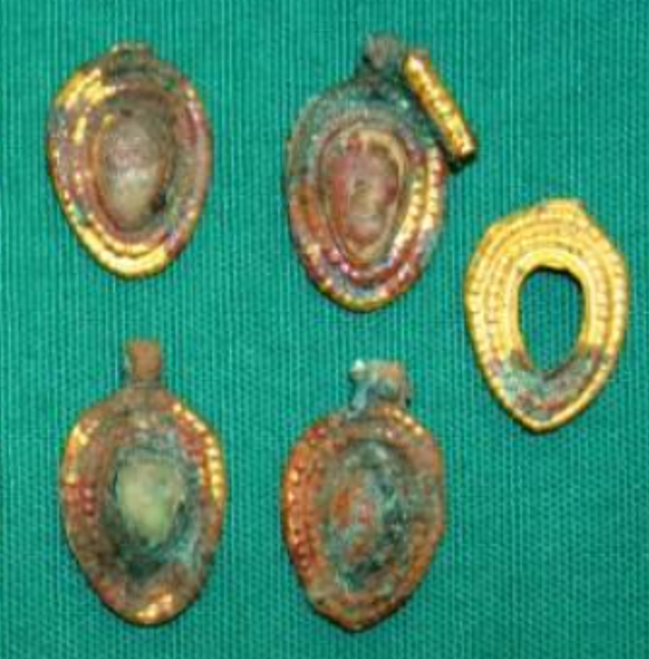 Thiết kế độc đáo của chúng đặt ra những câu hỏi quan trọng về các tập tục biểu tượng và văn hóa của những người sinh sống ở vùng Ganja-Gazakh này cách đây 4.000-5.000 năm trước. Ảnh: @Bảo Tàng Cộng Hòa Azerbaijan.