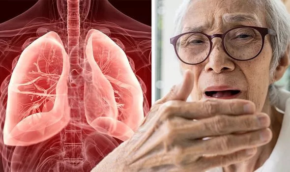 Hôi miệng có thể là dấu hiệu cảnh báo bệnh nhiễm trùng phổi Hoi mieng co the la dau hieu canh bao benh nhiem trung phoi